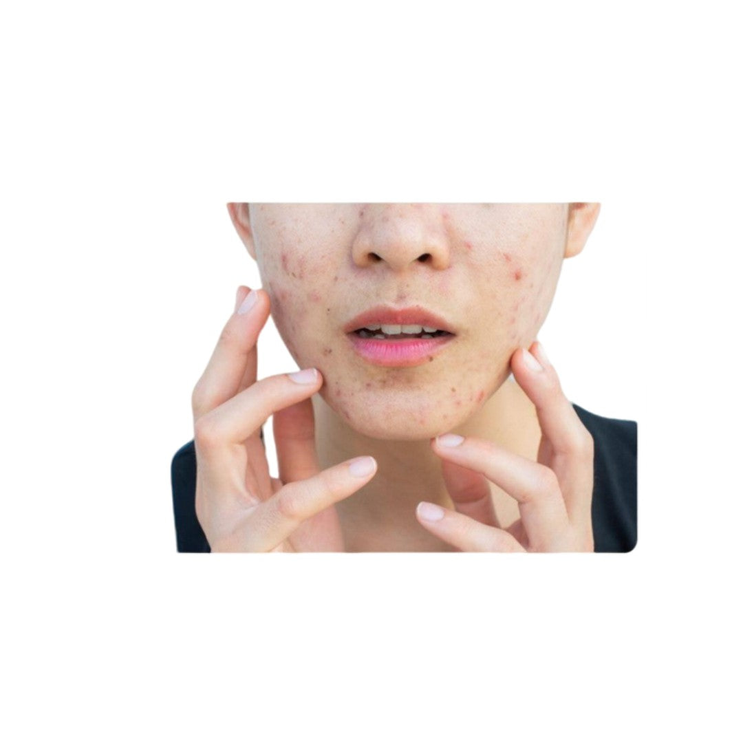 Noctis® — detox while you sleep