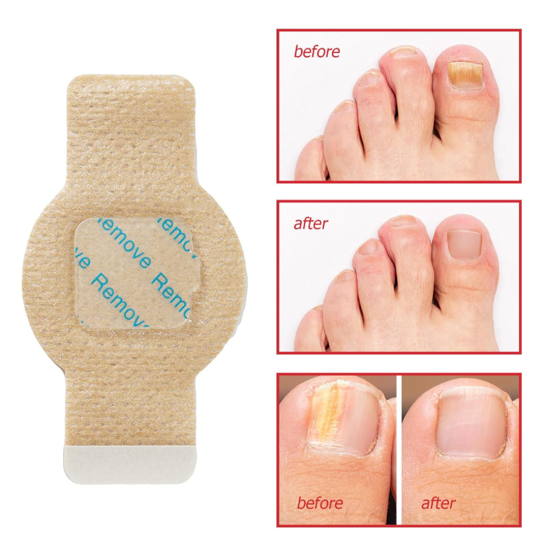 Fungal Nail Patches 21 Patches
