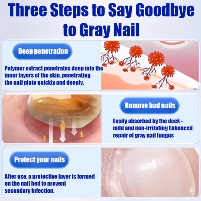 Fungal Nail Treatment Cream